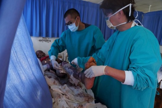 駐史瓦濟蘭醫療團整形外科蔡主任為燒燙傷病人換藥